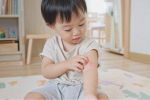 toddler scratching itchy eczema patch on elbow